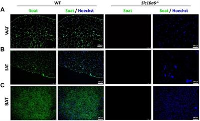 Role of the Steroid Sulfate Uptake Transporter Soat (Slc10a6) in Adipose Tissue and 3T3-L1 Adipocytes